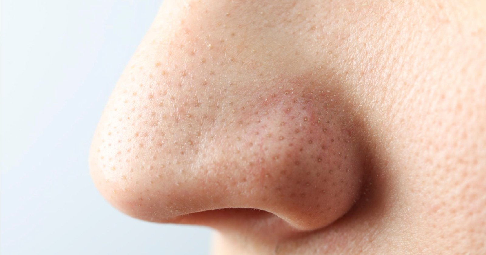 Anti-Aging Treatment In Bangalore